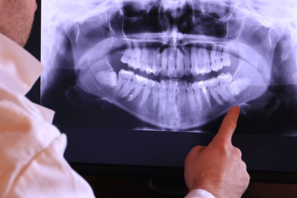 Best Emergency Treatment for Jaw Pain or Injury in Syracuse, NY